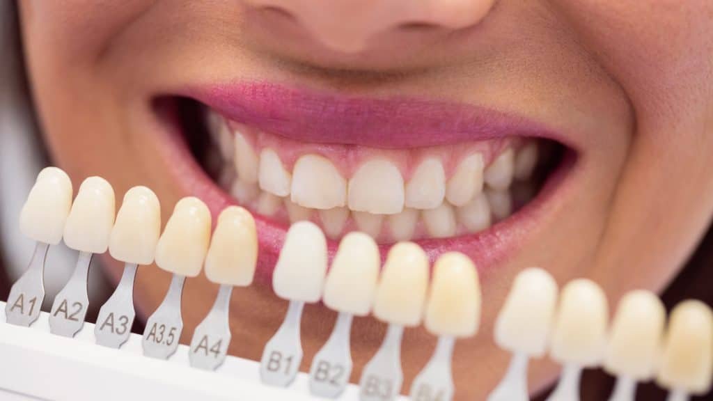 dental implant aftercare
