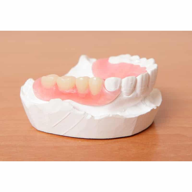 porcelain veneers service in Singapore