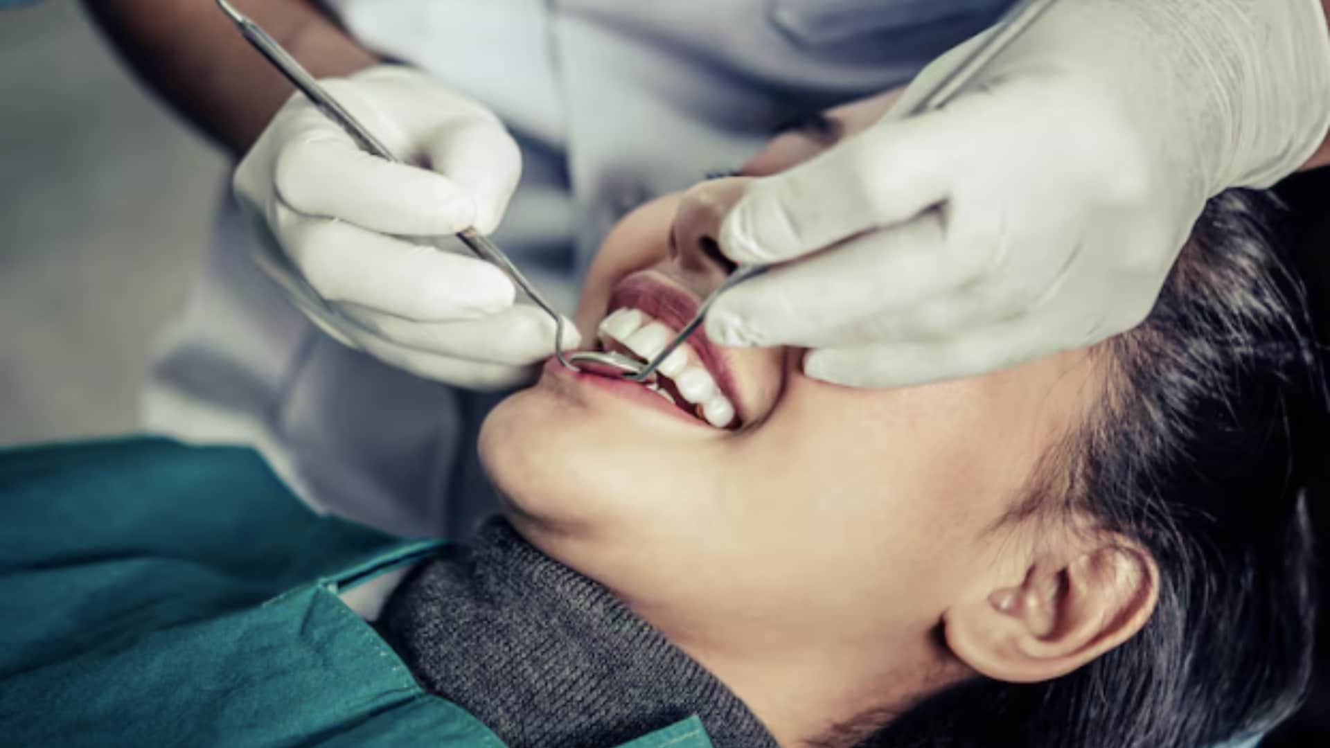 surgical wisdom tooth removal