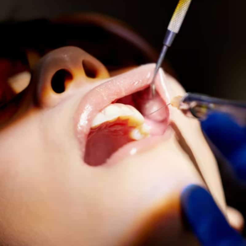 is dental surgery painfulwh