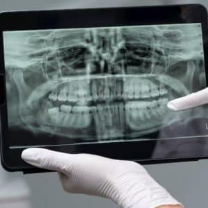 how often dental x ray needed